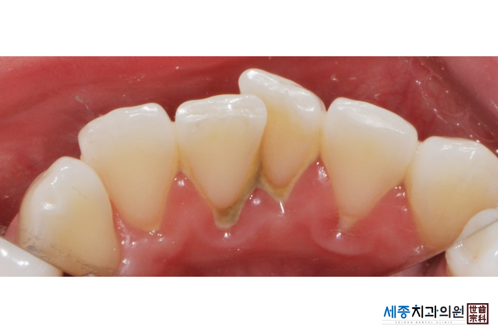 acae417ca6218510d0c35f7b2d2a1389.JPG