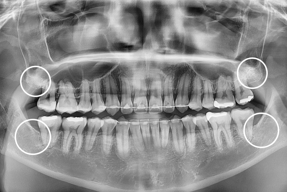 PX20220117_161559_0000_0000ACCB.jpg