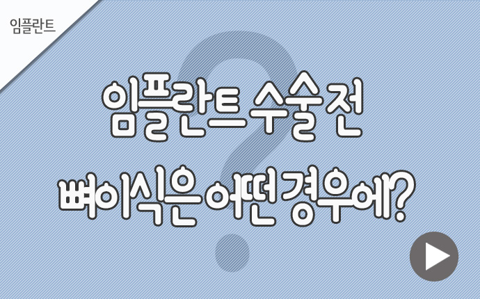 1임플란트 뼈이식은 어떤 경우.jpg