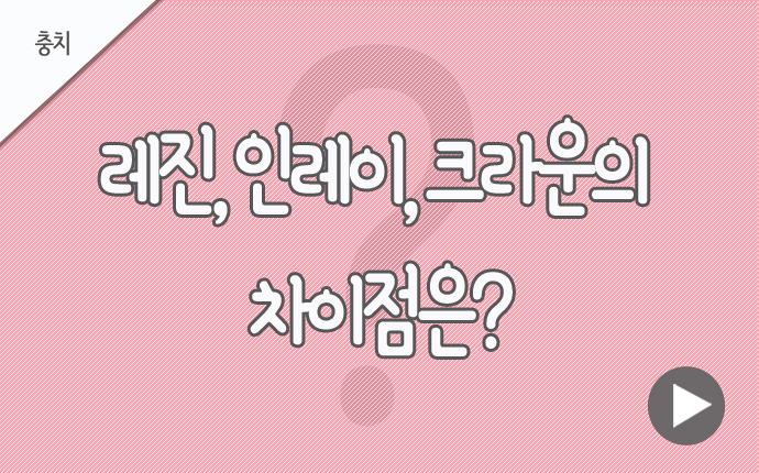 충치 레진 인레이.jpg