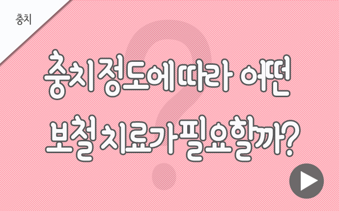 충치 충치정도.jpg
